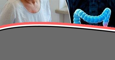 «سهلة» مش بس شرب المياه.. علاجات بيتية للإمساك