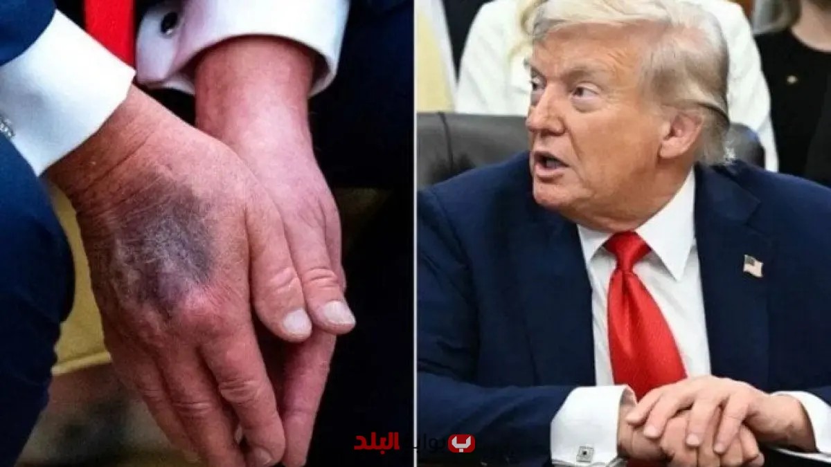أول رد أمريكي على شائعة وفاة ترامب بعد اختفائه عن الإعلام