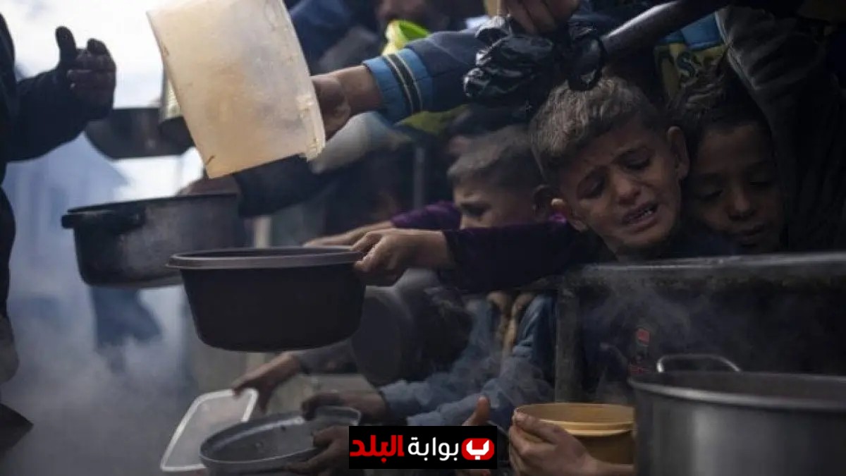 وفاة 5 أشخاص في غزة بسبب الجوع وسوء التغذية خلال 24 ساعة