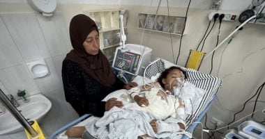 أونروا: غزة تحتضن أكبر مجموعة من الأطفال مبتورى الأطراف فى التاريخ الحديث