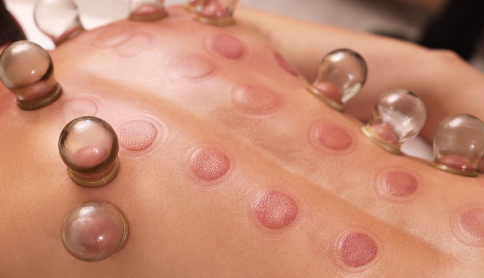 أفضل وقت لعمل الحجامة في شهر ديسمبر 2025