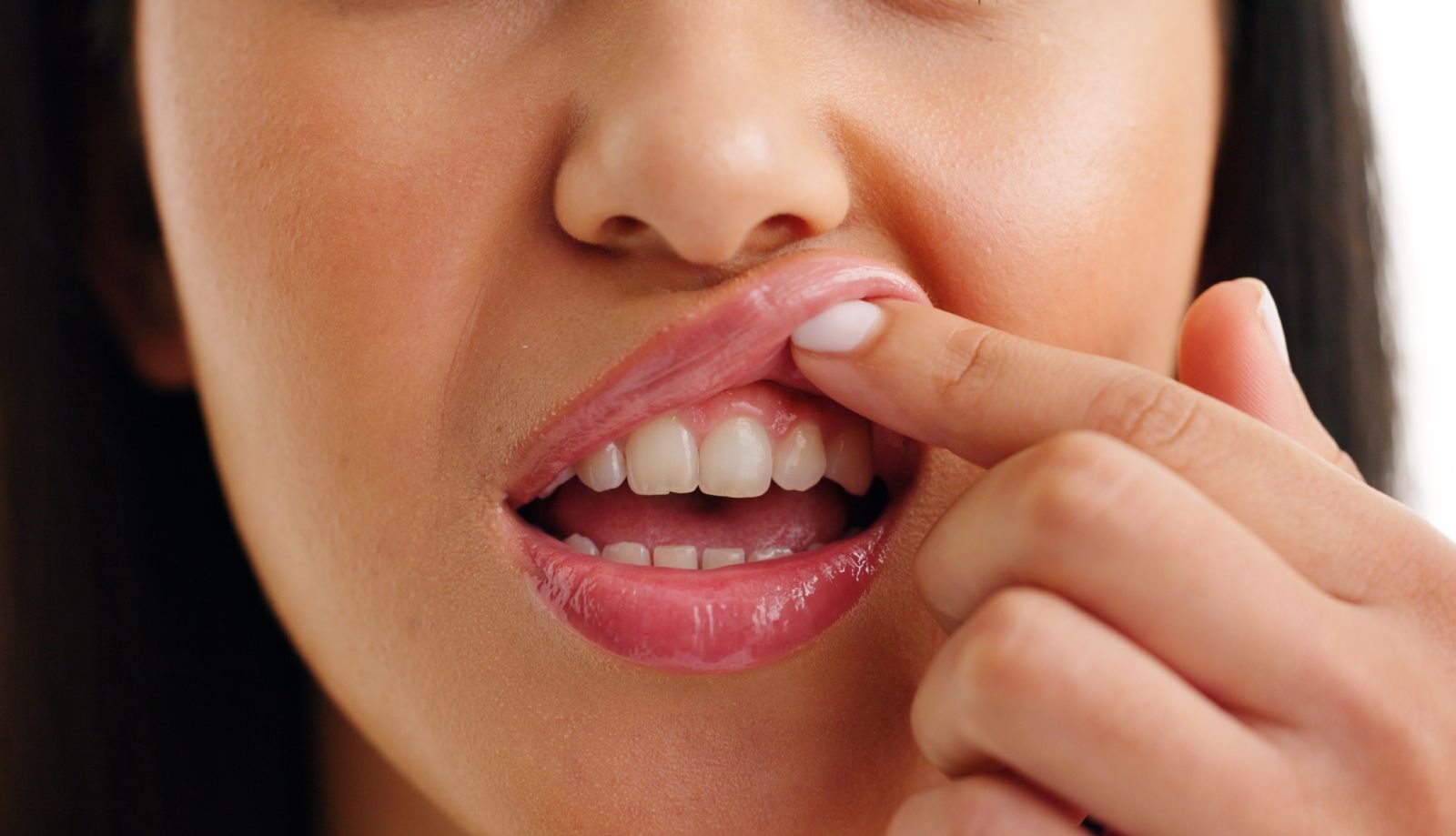 أسباب التهاب اللثة المستمر | البوابة